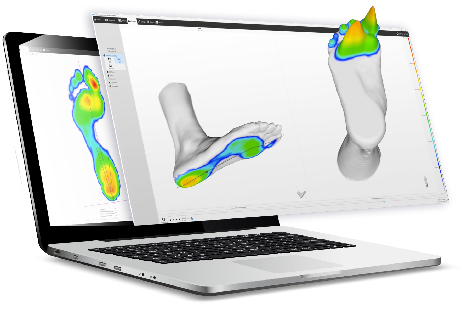 Computer-generated image displaying a heat map scan of two feet, highlighting various pressure areas. This image represents the software used in conjunction with the gait scanner and pressure plate.