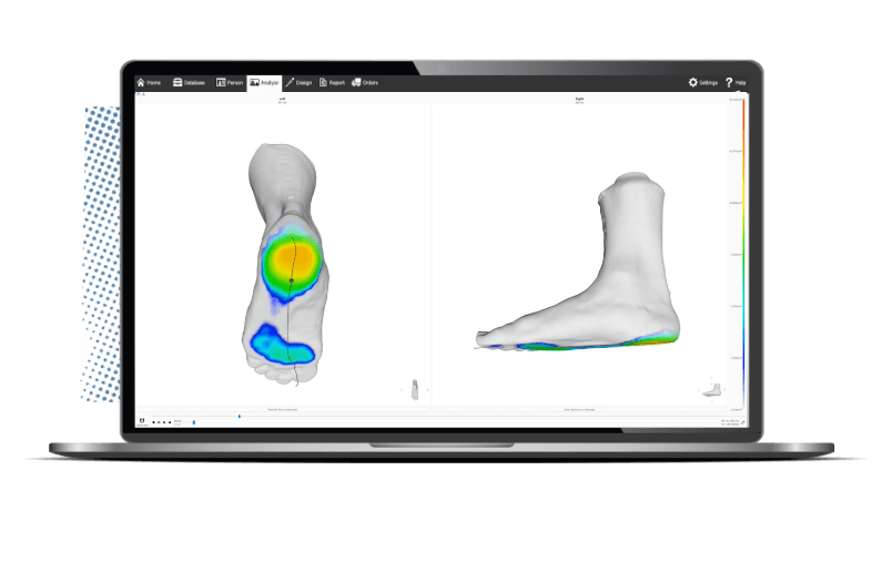 Image of a computer monitor displaying gait analysis software dispalying a patient's feet with visible heat maps representing pressure points. 